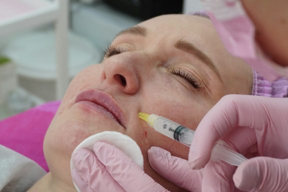 Facial Injections Model receiving facial injection